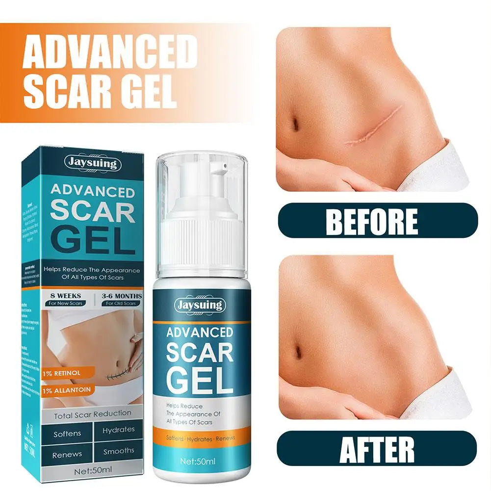 Prime Scar Removal Cream
