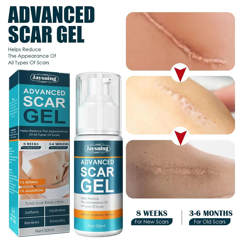 Prime Scar Removal Cream